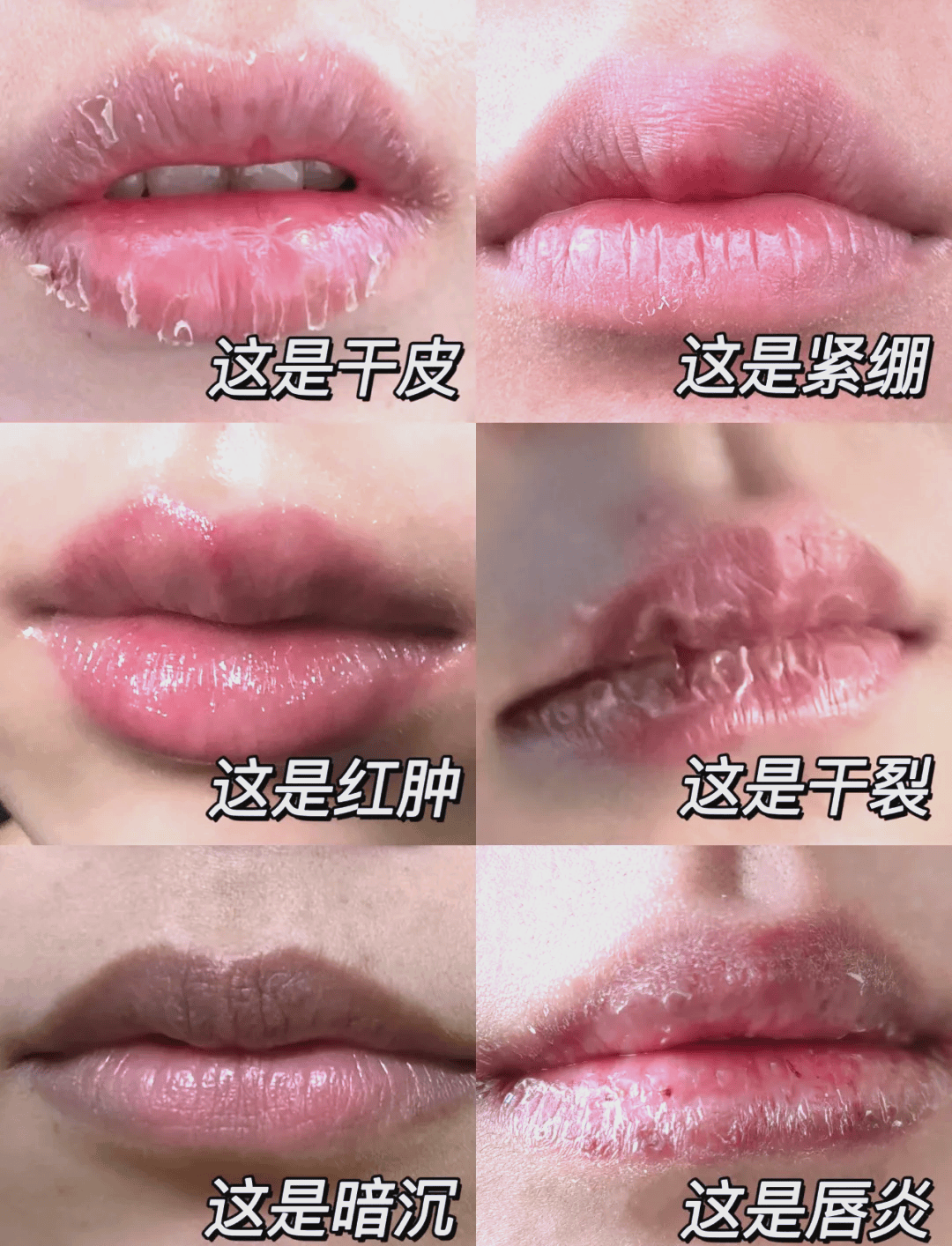 春季嘴唇乾燥、脫皮？教你幾個護唇小妙招，趕緊收藏起來~